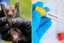 Bệnh Marburg là bệnh đặc biệt nguy hiểm, khả năng lây truyền và tỷ lệ tử vong cao. (Ảnh: tuoitre.vn)