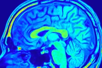 Hình chụp công hưởng từ não. Ảnh: FocalFinder/Shutterstock