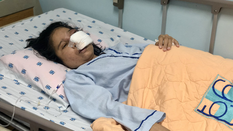 Thai phụ 29 tuần tuổi mắc bệnh hiếm gặp, nguy kịch đến tính mạng và thai nhi. Ảnh: BVCC