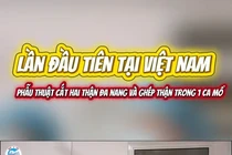 Khối u thận đa nang nặng gần 10 kg được lấy ra từ cơ thể bệnh nhân.