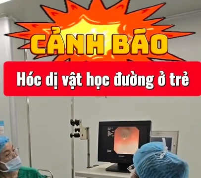 Dị vật là đầu bút được lấy ta từ phế quản bệnh nhân.