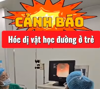 Dị vật là đầu bút được lấy ta từ phế quản bệnh nhân.