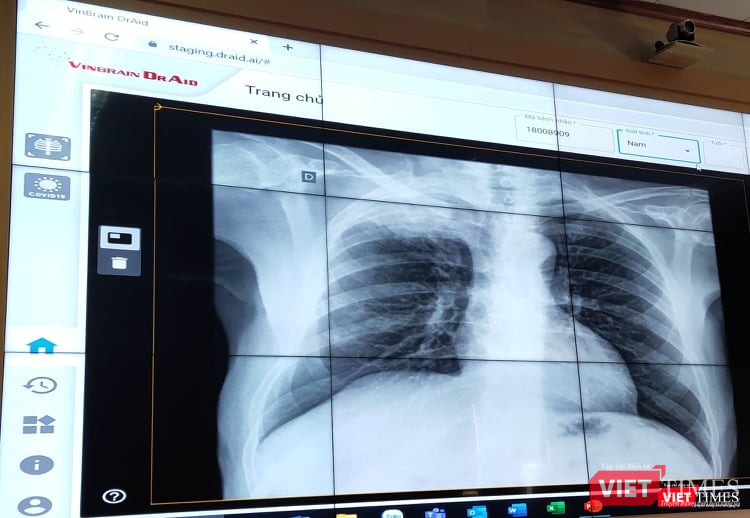 Ứng dụng VinBrain DrAi. (Ảnh: Minh Thúy)