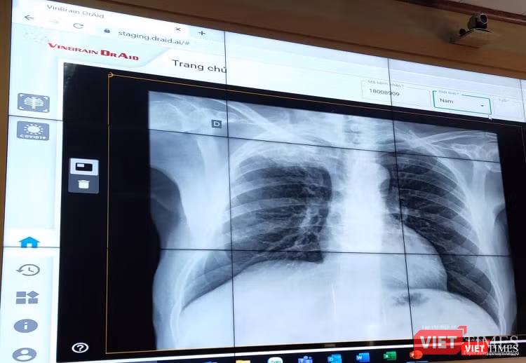 Ứng dụng VinBrain DrAi. (Ảnh: Minh Thúy)