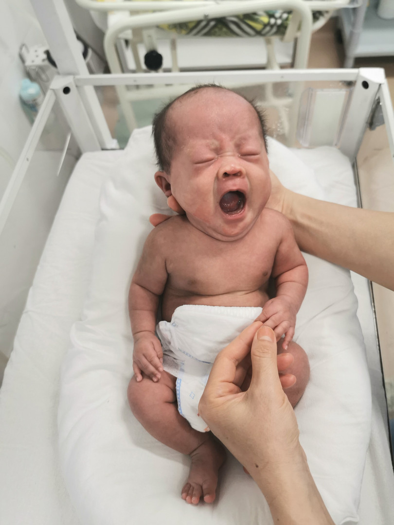 Bé sinh non ra đời chỉ nặng có 750g (Ảnh: Bệnh viện Phụ sản Hà Nội)