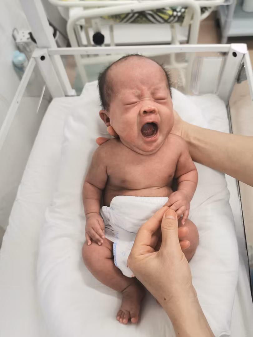 Bé sinh non ra đời chỉ nặng có 750g (Ảnh: Bệnh viện Phụ sản Hà Nội)