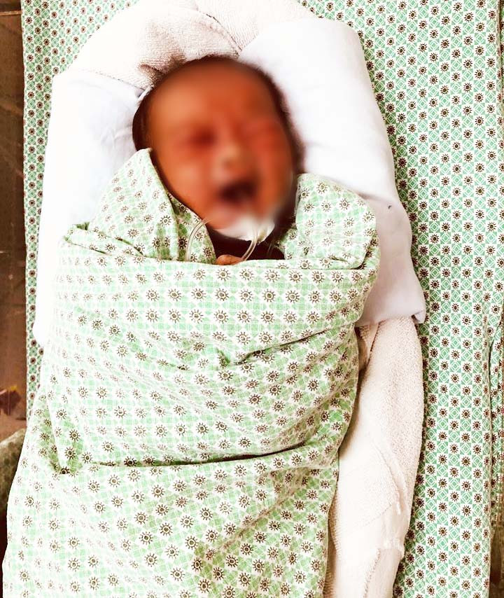 Bé sơ sinh 3 ngày tuổi bị bỏ rơi ở hố ga nhập viện trong tình trạng bị tổn thương khắp người. Ảnh: Kim Oanh