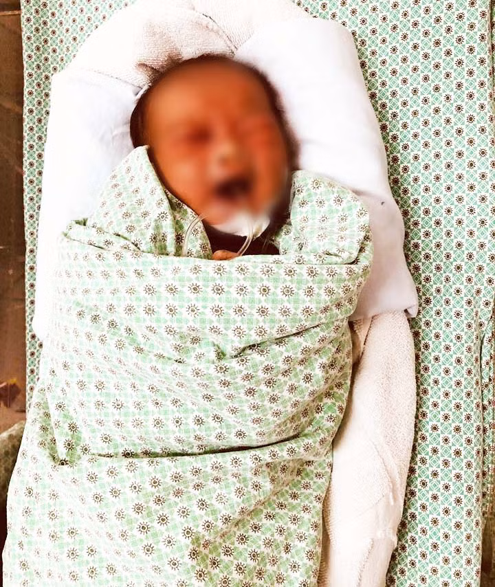 Bé sơ sinh 3 ngày tuổi bị bỏ rơi ở hố ga nhập viện trong tình trạng bị tổn thương khắp người. Ảnh: Kim Oanh