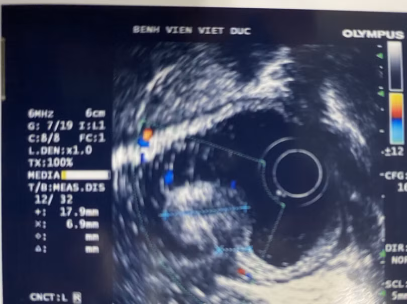 Hình ảnh siêu âm của bệnh nhân (Ảnh: Bệnh viện Hữu nghị Việt Đức)
