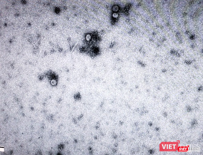 Virus SARS-CoV-2 (Ảnh: Minh Thúy)