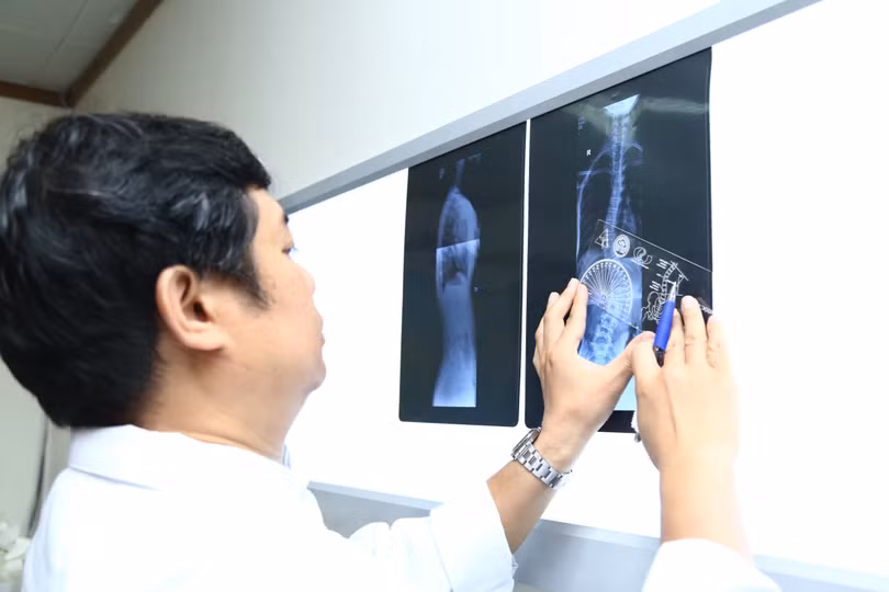 Bác sĩ xem phim chụp X-quang của bệnh nhân (Ảnh: BVCC)