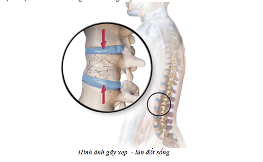 Ảnh: BVCC Ảnh: BVCC