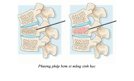 Ảnh: BVCC Ảnh: BVCC