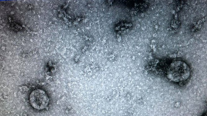 Virus SARS-CoV-2 (Ảnh: Minh Thúy)