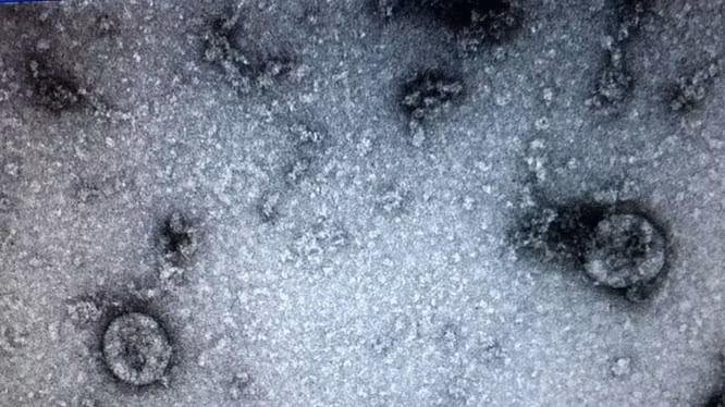 Virus SARS-CoV-2 (Ảnh: Minh Thúy)