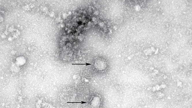 Hình ảnh virus corona chủng mới dưới ống kính hiển vi (Ảnh: Đông Phương)