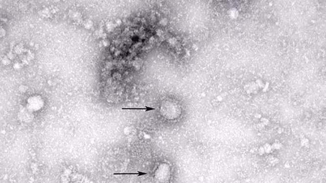 Hình ảnh virus corona chủng mới dưới ống kính hiển vi (Ảnh: Đông Phương)