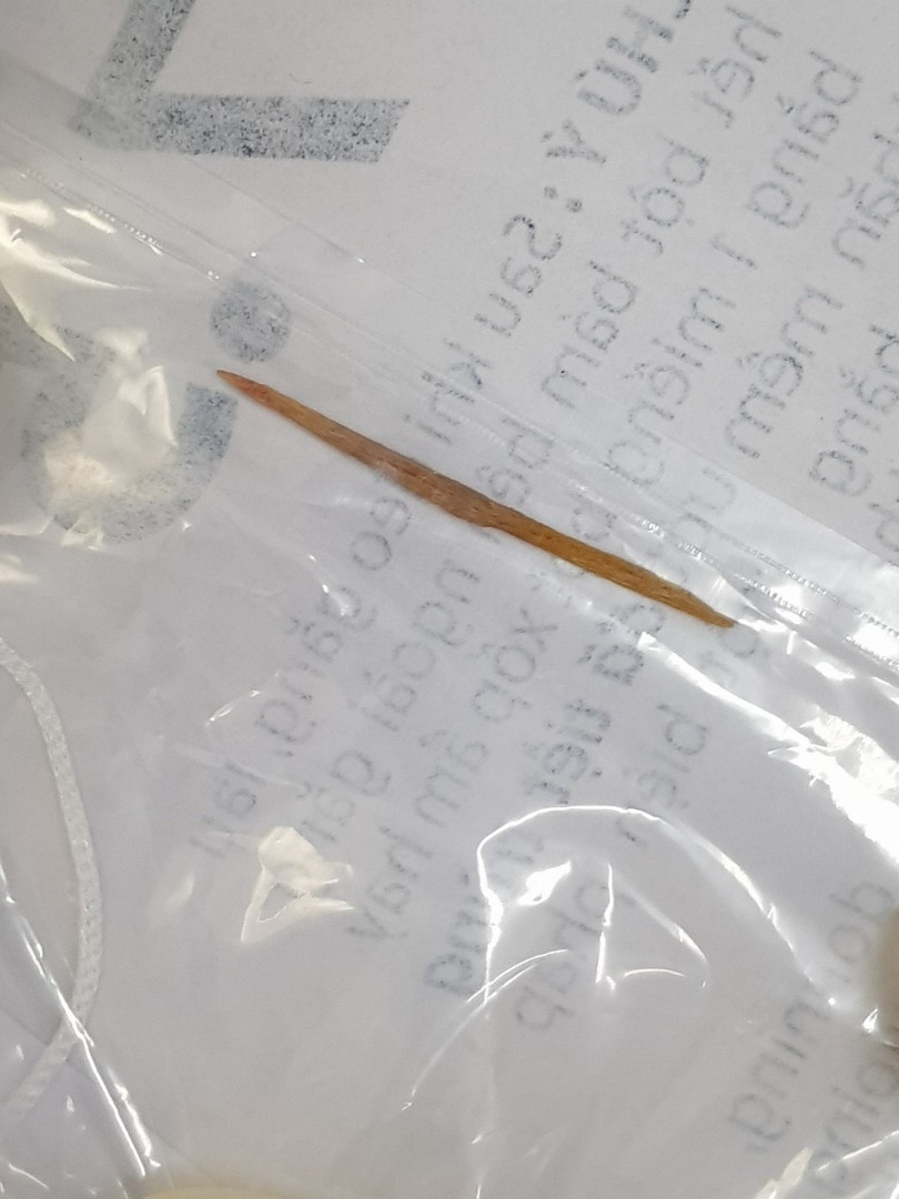 Chiếc tăm tre được lấy ra sau khi đâm thủng ruột non của bệnh nhân (Ảnh: Bệnh viện Hữu nghị Việt Đức) Chiếc tăm tre được lấy ra sau khi đâm thủng ruột non của bệnh nhân (Ảnh: Bệnh viện Hữu nghị Việt Đức)