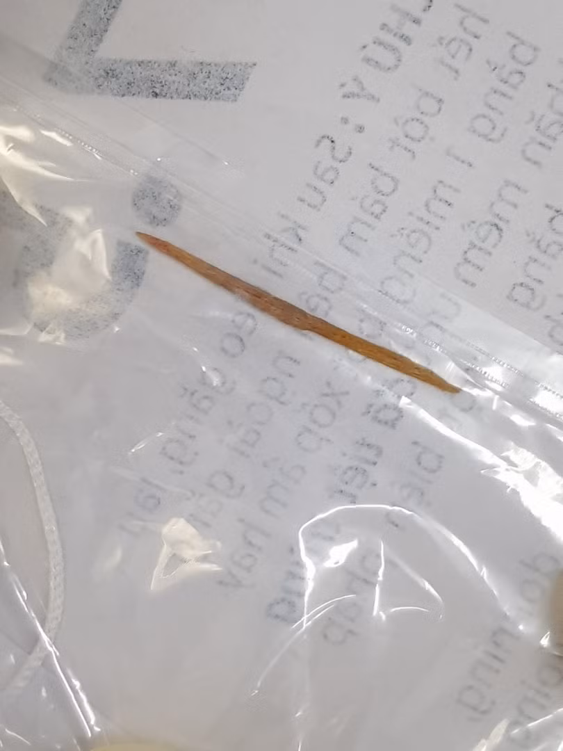 Chiếc tăm tre được lấy ra sau khi đâm thủng ruột non của bệnh nhân (Ảnh: Bệnh viện Hữu nghị Việt Đức) Chiếc tăm tre được lấy ra sau khi đâm thủng ruột non của bệnh nhân (Ảnh: Bệnh viện Hữu nghị Việt Đức)