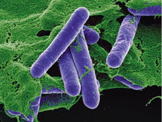 C. botulinum - vi khuẩn Gram dương kỵ khí bắt buộc, sinh bào tử và có khả năng di động. (Nguồn: CDC.gov) C. botulinum - vi khuẩn Gram dương kỵ khí bắt buộc, sinh bào tử và có khả năng di động. (Nguồn: CDC.gov)