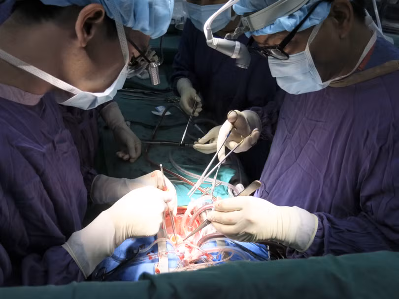 PGS.TS Nguyễn Hữu Ước – Giám đốc Trung tâm Tim mạch và lồng ngực, Bệnh viện Hữu nghị Việt Đức đang phẫu thuật ghép tim cho bệnh nhân (Ảnh BVCC)