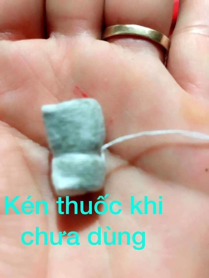 Kén thuốc khi chưa dùng (Ảnh: FB H.T)