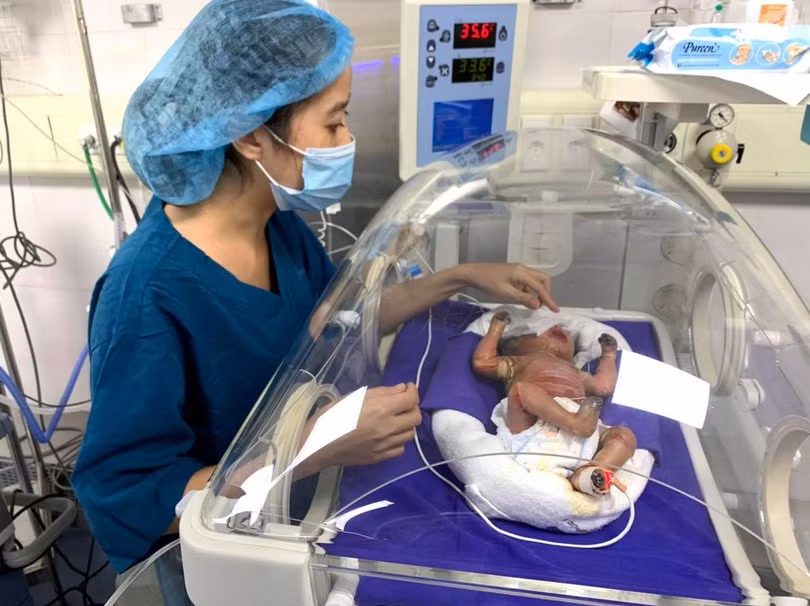 Các bác sĩ đang nỗ lực chăm sóc cho bé trai sinh non mắc bệnh hiếm (Ảnh: Bệnh viện Sản Nhi Quảng Ninh)