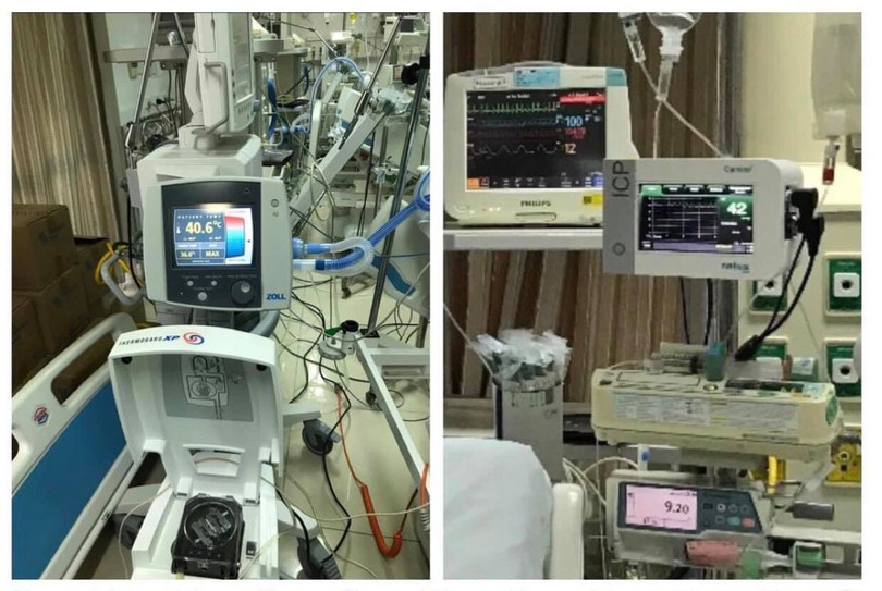 Các thiết bị y tế hiện đại được các bác sĩ sử dụng để hạ thân nhiệt chỉ huy cho bệnh nhân (Ảnh: BVCC)