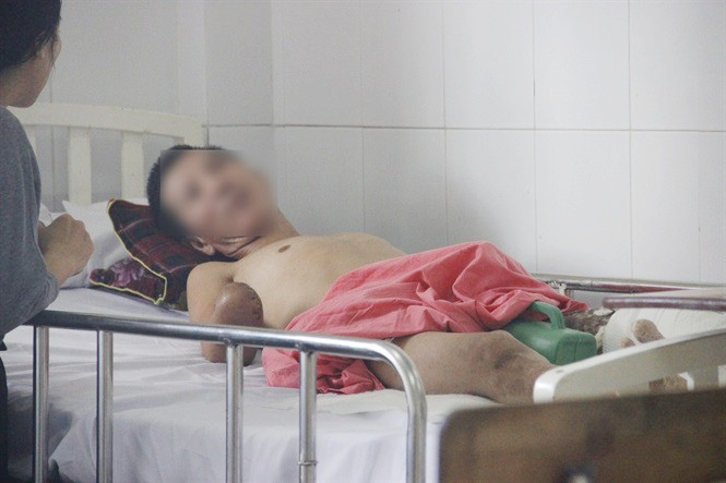 Nạn nhân Anh Khoa đang được điều trị