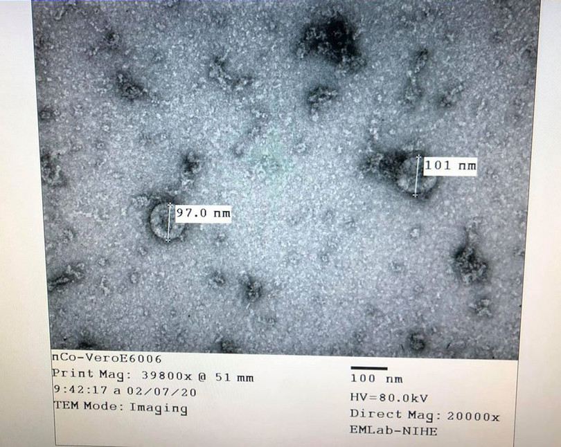 Nuôi cấy, phân lập thành công nCoV giúp các xét nghiệm được thực hiện nhanh. Ảnh: Viện Vệ sinh dịch tễ Trung ương