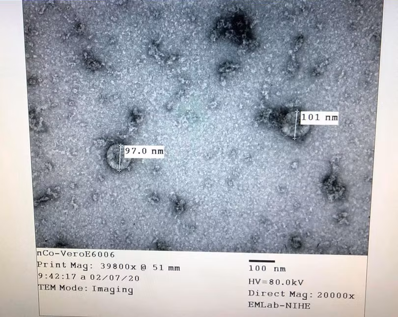 Nuôi cấy, phân lập thành công nCoV giúp các xét nghiệm được thực hiện nhanh. Ảnh: Viện Vệ sinh dịch tễ Trung ương