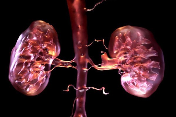 Hội chứng thận hư thực chất là một bệnh mạn tính. Ảnh: Internet