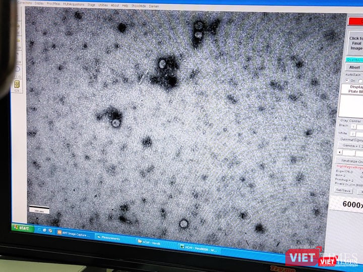 Virus Corona đã được phân lập. Ảnh: Minh Thúy