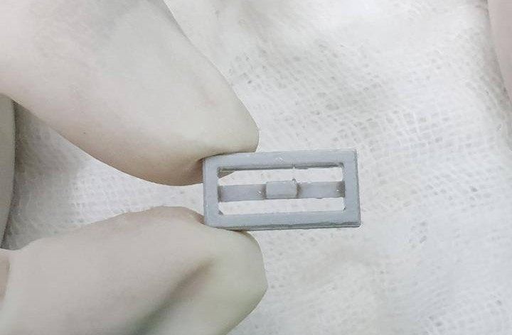 Khối lego bị bé trai nuốt nhầm