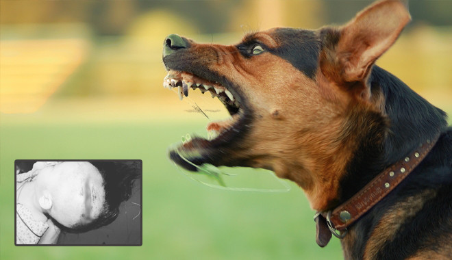 Chó nhà tấn công khiến trẻ phải đi cấp cứu (Ảnh minh họa)