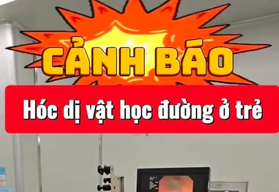 Dị vật là đầu bút được lấy ta từ phế quản bệnh nhân.