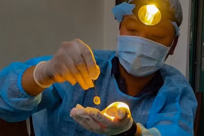 Giác mạc sinh học mở hy vọng cho hơn nửa triệu người mù tại Việt Nam