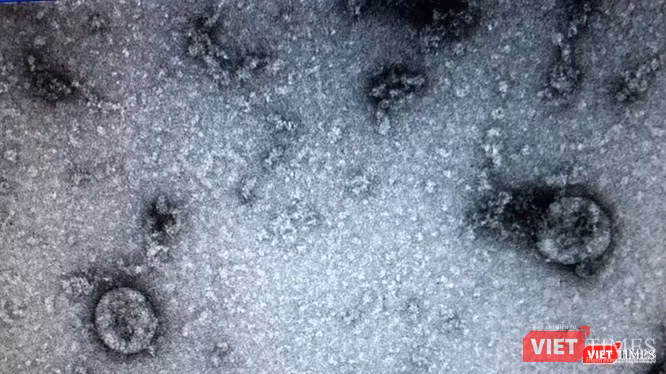 Virus SARS-CoV-2 (Ảnh - Minh Thuý)