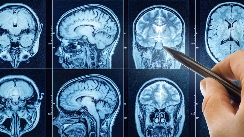 nao - Shutterstocks.jpg