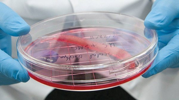 Máy in sinh học có thể giúp tạo ra những bộ phận cơ thể có thể thay thế bộ phận bị hỏng, như niệu đạo trong hình.