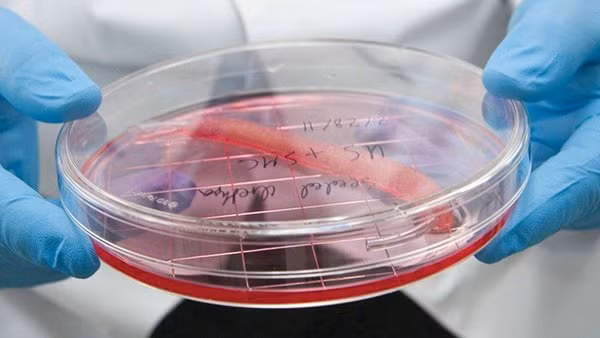 Máy in sinh học có thể giúp tạo ra những bộ phận cơ thể có thể thay thế bộ phận bị hỏng, như niệu đạo trong hình.