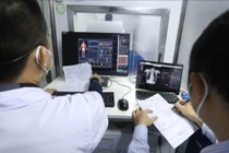 Tranh cãi “chụp X-quang 6 phút, siêu âm 30 phút”: BHXH bác cách hiểu cứng nhắc về thanh toán BHYT