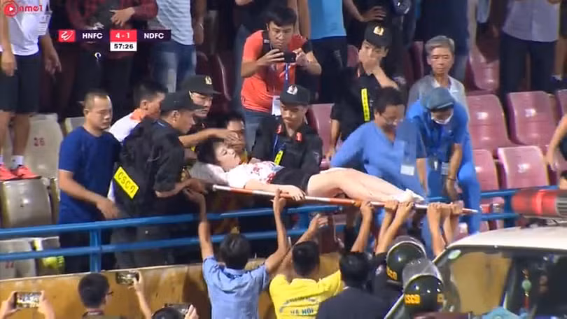 Hà Nội – Nam Định (6-1): mưa bàn thắng và pháo sáng khiến một cổ động viên phải cấp cứu ảnh 3 Máu đã đổ. Ảnh HNFC.