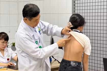 Phát hiện muộn, nhiều trẻ vẹo cột sống nặng bị biến dạng lồng ngực, mất cơ hội điều trị tối ưu