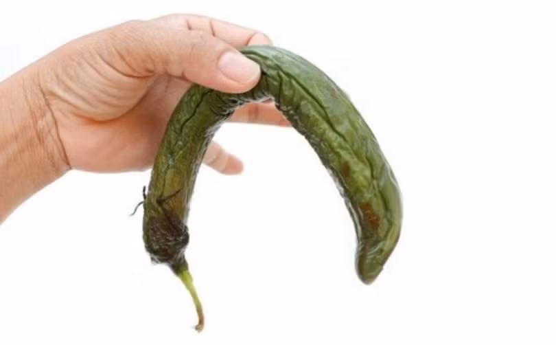Nma giới cần đặc biệt lưu ý khi thấy dương vật có những biểu hiện bất thường (Ảnh minh hoạ)