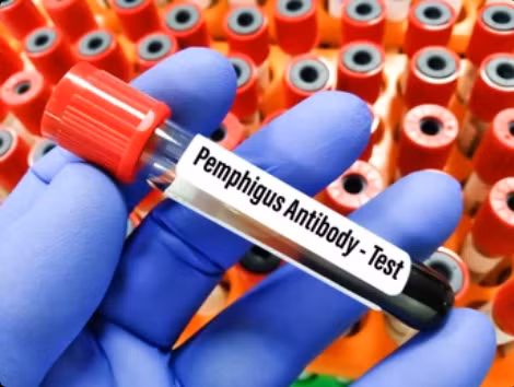 anti-pem-9050.png