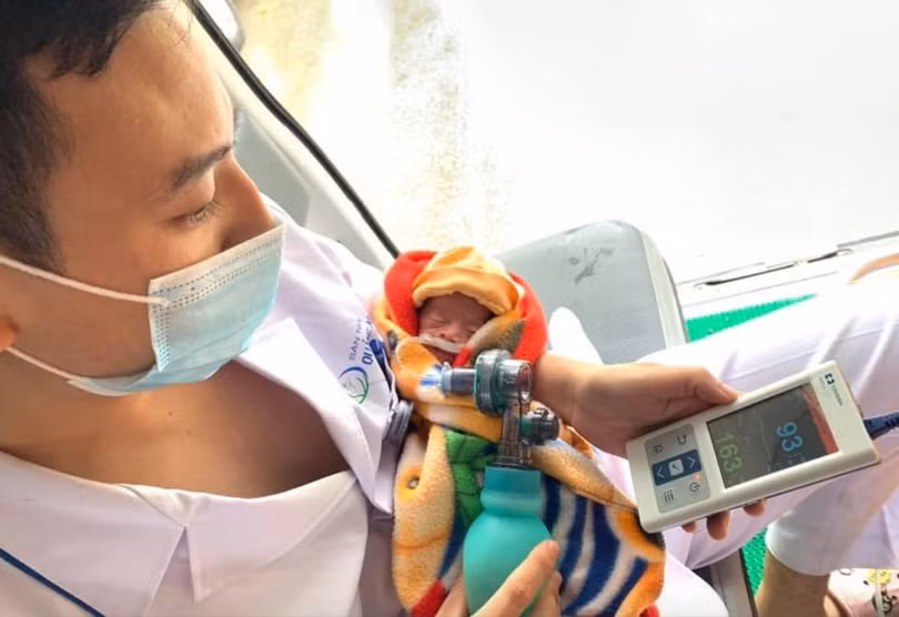 Bé sinh non 29 tuần được bác sĩ tại Bệnh viện Sản nhi Quảng Ninh chăm sóc (Ảnh: BVCC) 