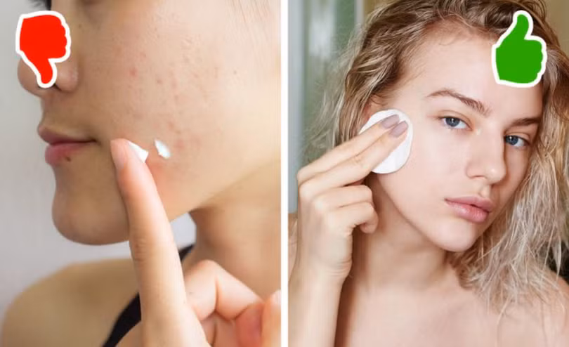 Bôi kem đánh răng lên da có thể gây kích ứng (Ảnh: BrightSide) Bôi kem đánh răng lên da có thể gây kích ứng (Ảnh: BrightSide)
