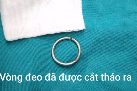 Suýt hoại tử tinh hoàn vì chiếc vòng kim loại đường kính 3 cm