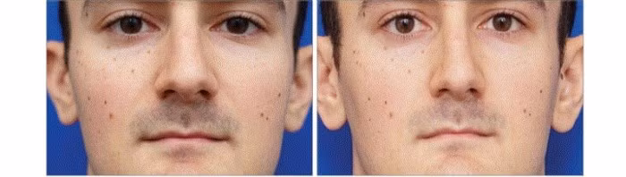 Bí mật sống ảo: Chụp selfie khiến mũi bạn trông to hơn thực tế - Ảnh 1